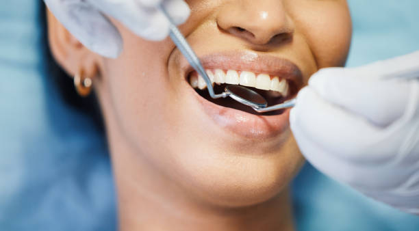 Best Emergency Broken Tooth Repair in Harris Hill, NY