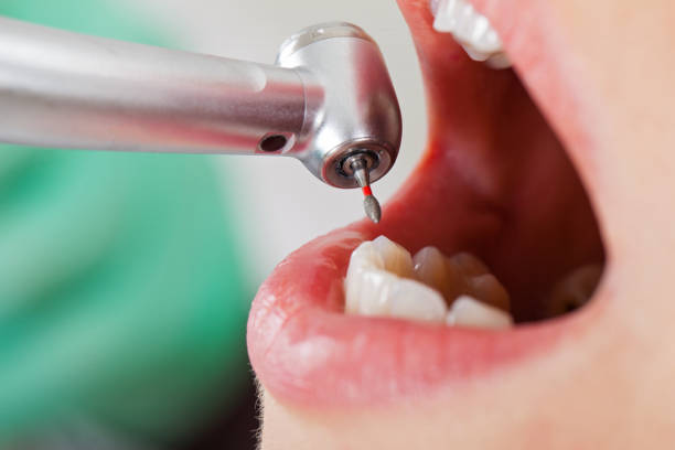Best Pediatric Emergency Dentist in Harris Hill, NY